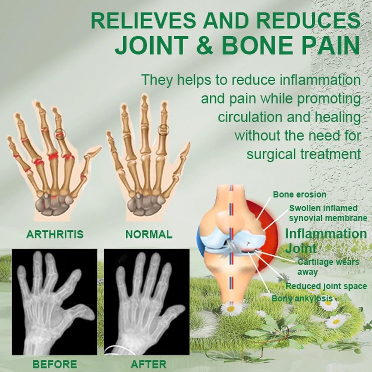 Bee Venom Joint and Bone Therapy Cream | š„ BUY 1 GET 1 FREEš„|
