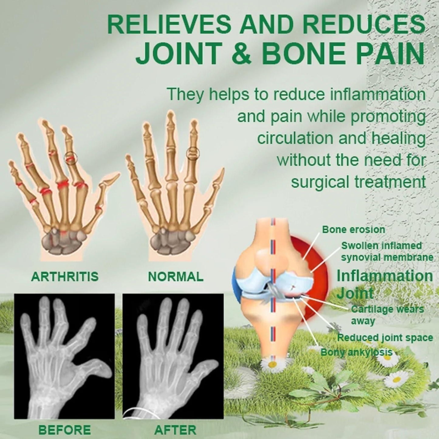 Bee Venom Joint and Bone Therapy Cream | š„ BUY 1 GET 1 FREEš„|